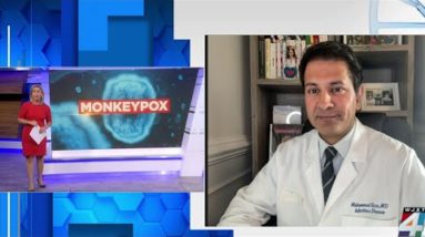 Increase in monkeypox cases